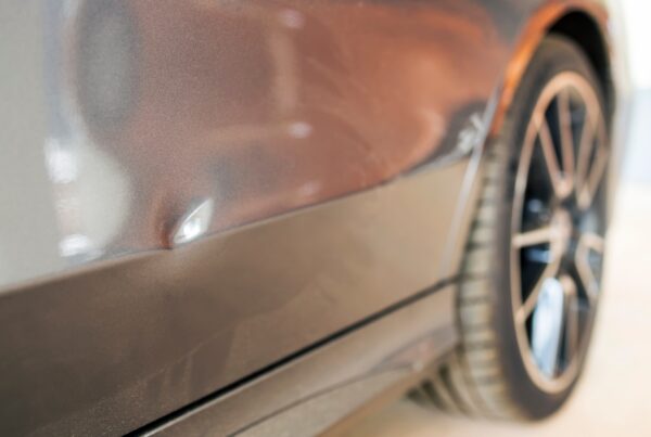 Dents
