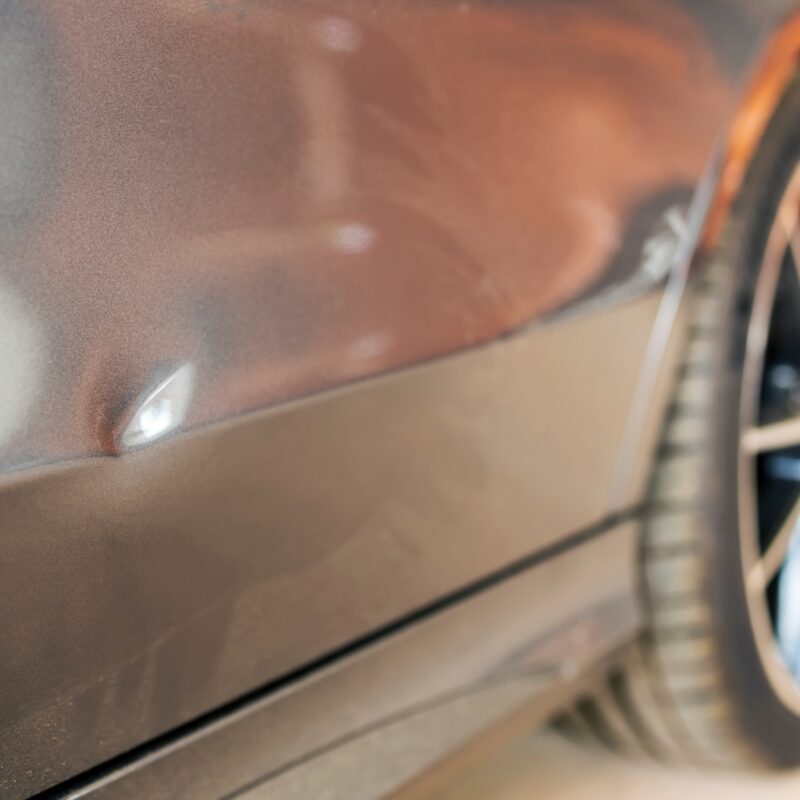Dents